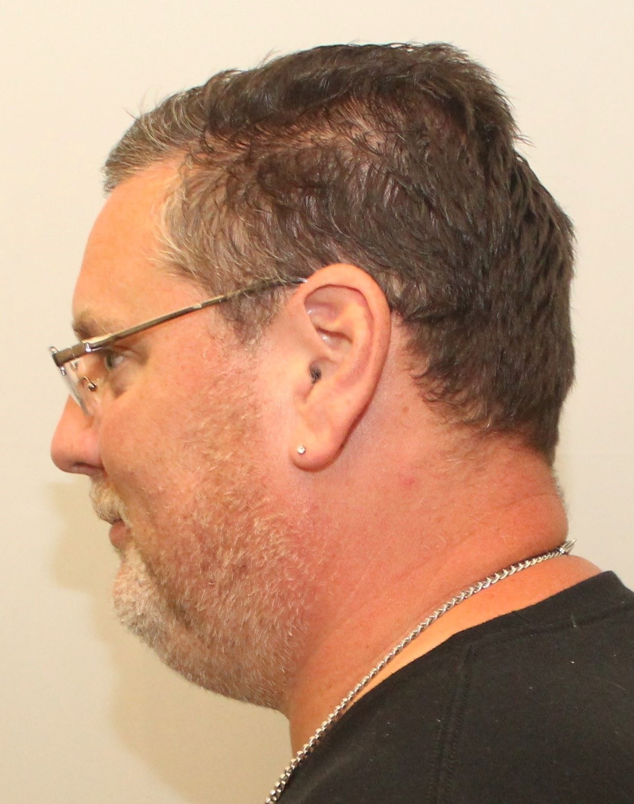 Mugshot Side